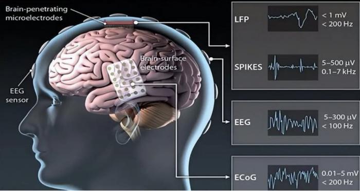 趋势丨马斯克的新愿景对准盲人，Neuralink下一代脑机接口已获批