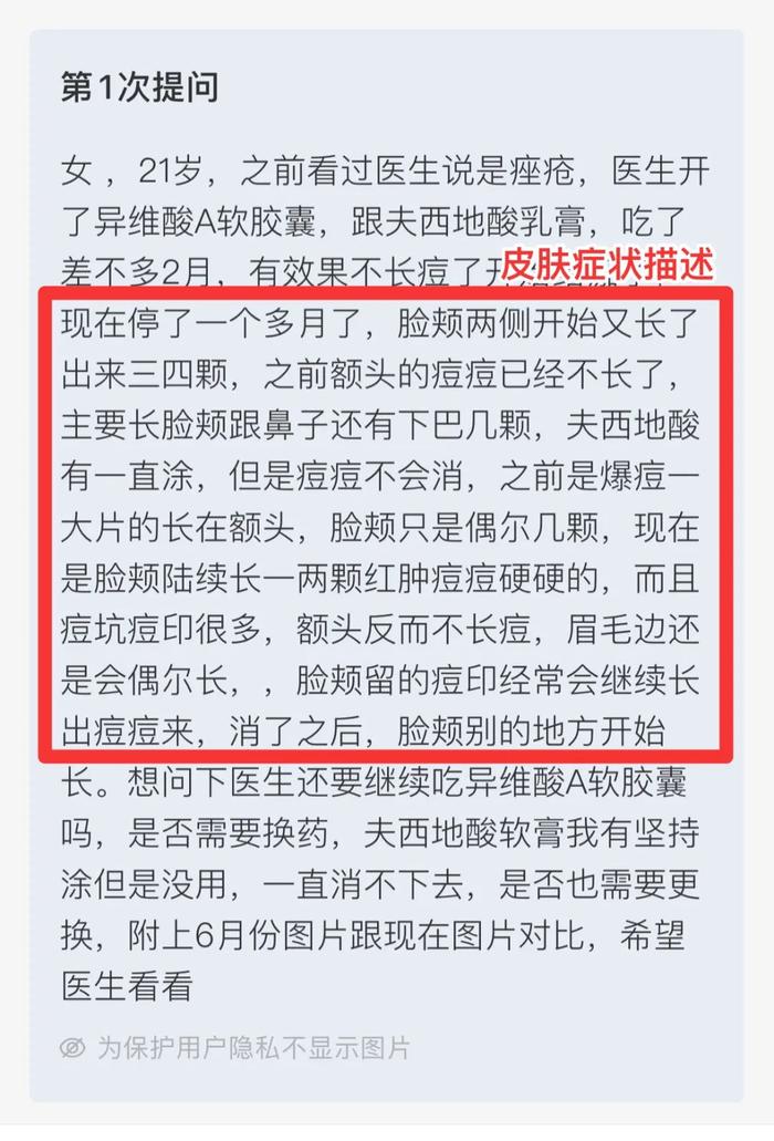 为什么别人的痘一治就好，我的就不行？