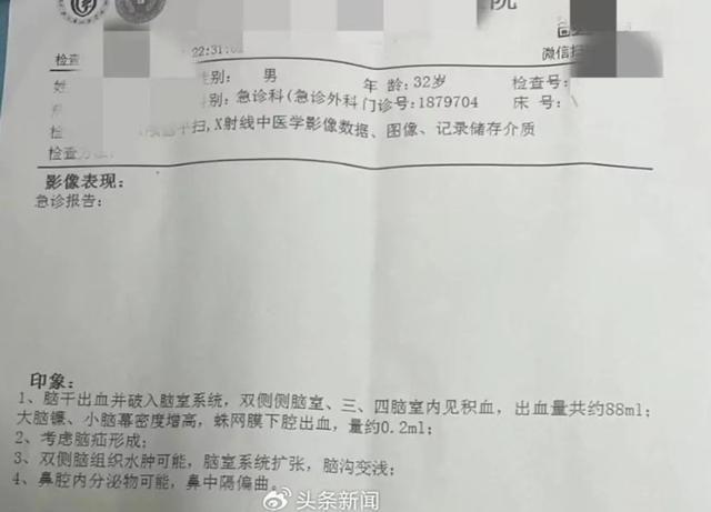 在直播后突发脑溢血被送进ICU