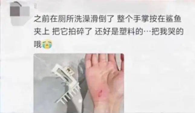 网红鲨鱼夹让她成了植物人！医生紧急提醒