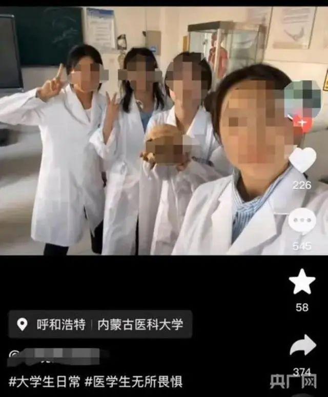 医学生和大体老师头骨微笑合影被骂，冤吗？