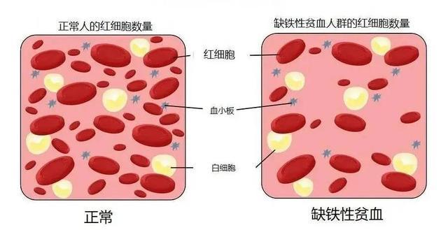 上热搜！女孩一天喝3杯“它”、不吃“它”，确诊贫血！很多人每天不离手，医生提醒→