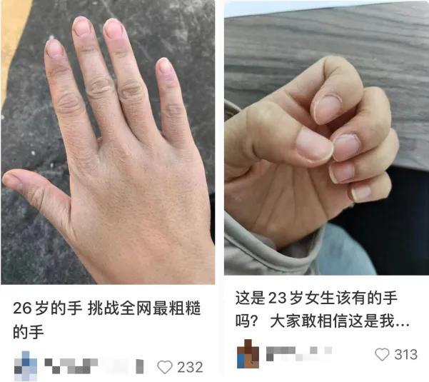 别光保养脸了，这个部位才是P图都救不了……