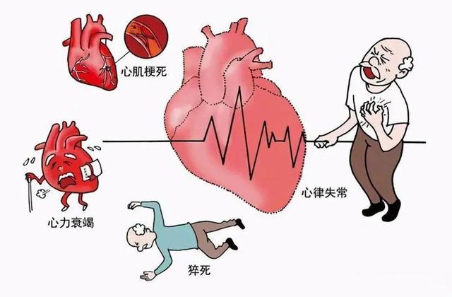 注意注意！气温骤降，这个致命的病更加易发丨健康总动员