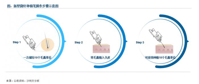 大麦微针植发：新型微针引领脱发治疗新时代革命