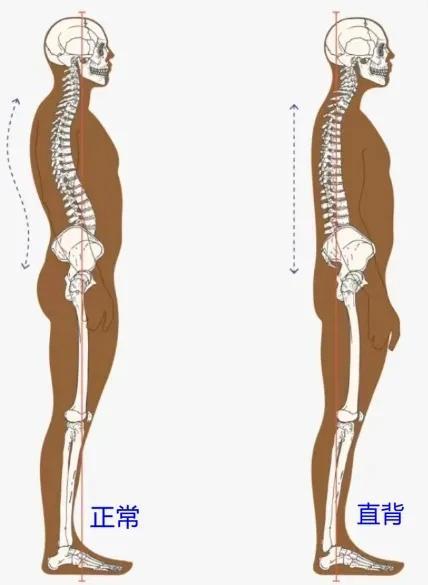 这7个姿势，正加速你的脊椎报废！很多人天天在做！估计你全中……