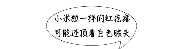 胸前长了小米粒的“红痘”，要挤出来吗？