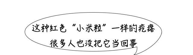 胸前长了小米粒的“红痘”，要挤出来吗？