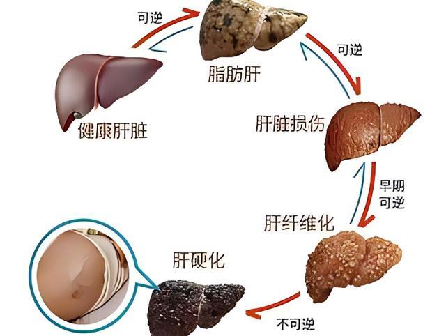 学点“肝”货，告别“肝”扰——沪东社区中医肝病科门诊