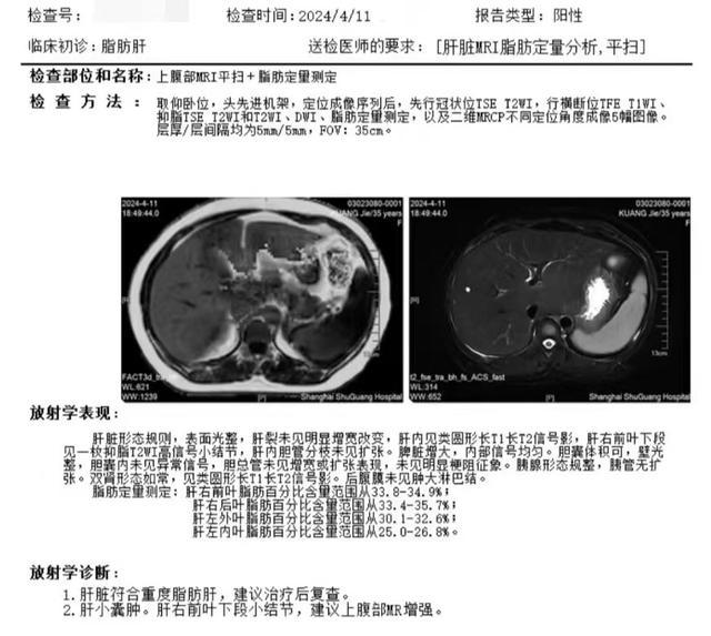 学点“肝”货，告别“肝”扰——沪东社区中医肝病科门诊