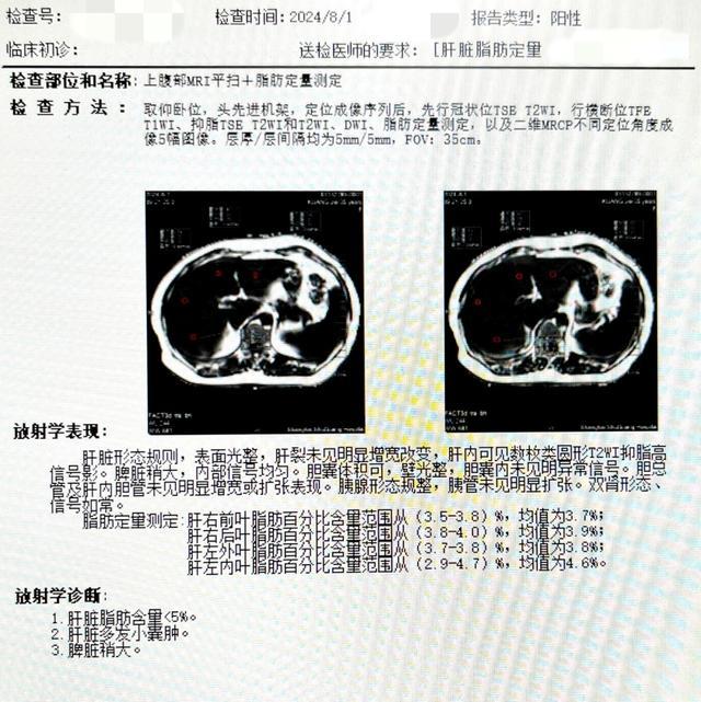 学点“肝”货，告别“肝”扰——沪东社区中医肝病科门诊