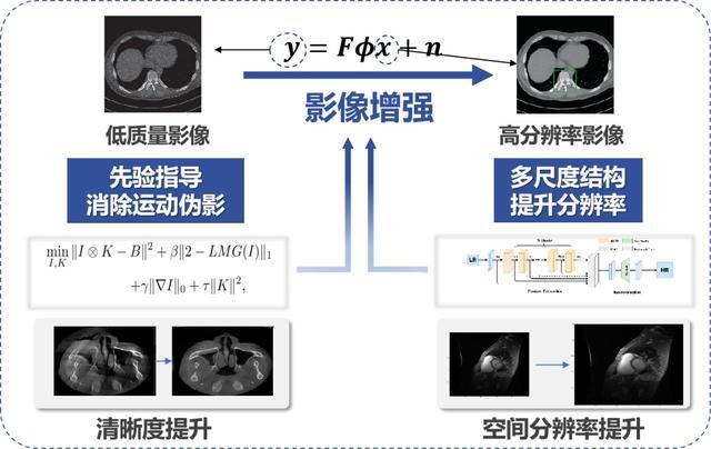 快速磁共振成像与增强研究助力高端医疗设备国产化｜上海市科学技术奖