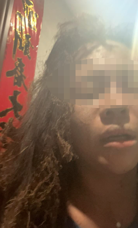 对话被伪装快递盒炸伤女主播:嫌疑人放易燃物时疑戴面具,被其骚扰两年,总共见过三次