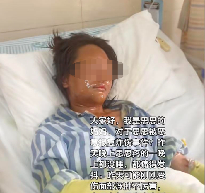 对话被伪装快递盒炸伤女主播:嫌疑人放易燃物时疑戴面具,被其骚扰两年,总共见过三次