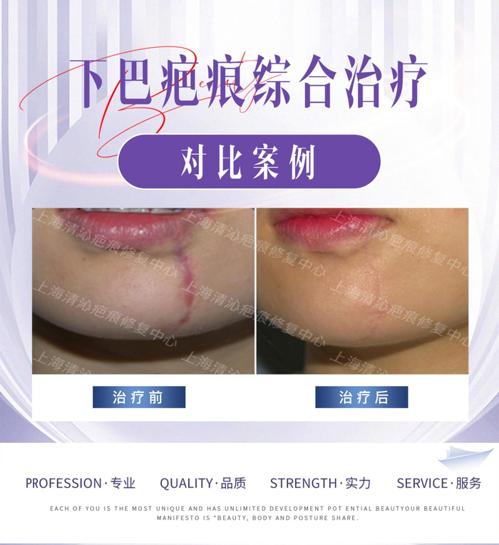 w700d1q75cms.jpg?by=cms_fixed_width