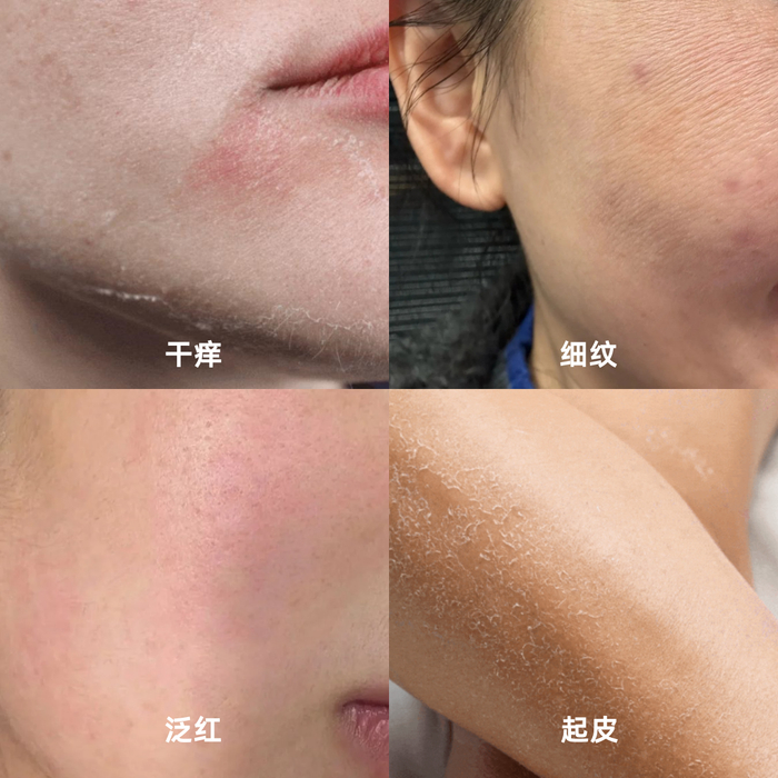 (图源于网友分享,仅供参考)