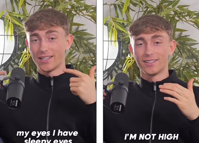 为何眼睛总睁不开？西媒：赫伊森患先天性眼睑下垂，不会影响视力