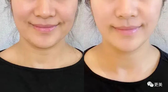 △效果因人而异