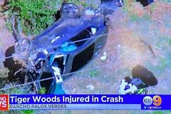 伍兹遭遇严重车祸 腿部受伤已接受手术无生命危险