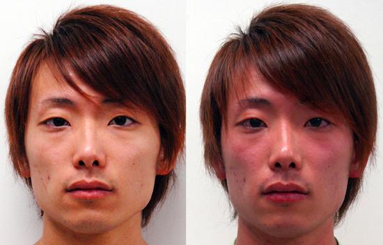 喝酒脸红,隐藏着健康风险,图源:plos.org