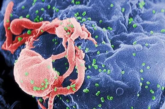 HIV-1病毒正从培养出来的淋巴球出芽。图片来源:wikimedia