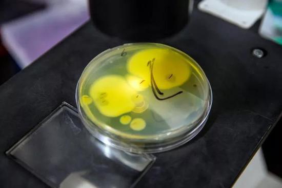 培养皿里的白色念珠菌(Candida albicans)。| 图片来源:ARAM BOGHOSIAN FOR STAT