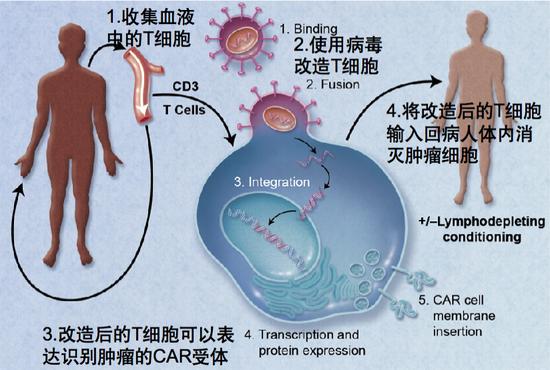 图15。 CAR-T细胞治疗