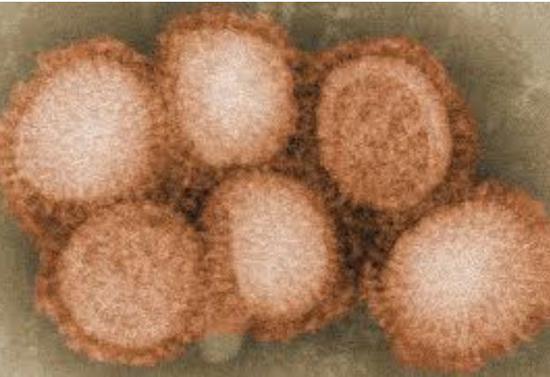 2009年猪流感H1N1病毒