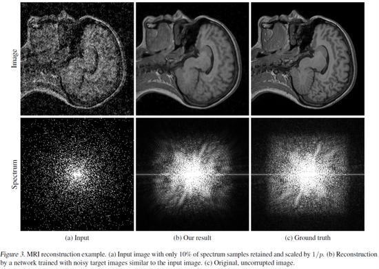 ▲ 从左到右:投喂给 AI 的带噪点 MRI 成像、AI 处理后效果、原图