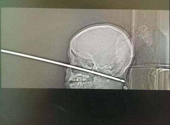 Credit: Medical News Network/Cliff Erwin