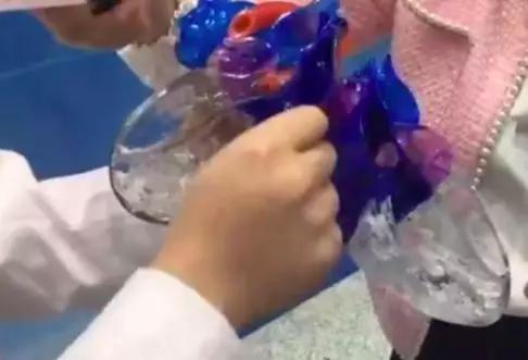 通过影像也可以观察到,患者的心脏占据了整个胸腔的2/3以上。