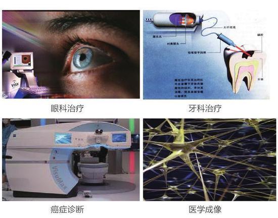 图6 飞秒激光(超强超短激光)治疗近视,来源:公有领域