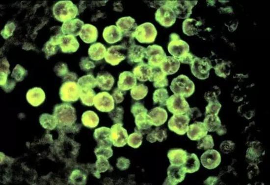 图为显微镜下观察到的、经荧光抗体染色的福氏内格里阿米巴原虫。图源:美国疾病控制与预防中心
