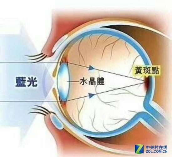 伤害视力的根源其实是蓝光。。。