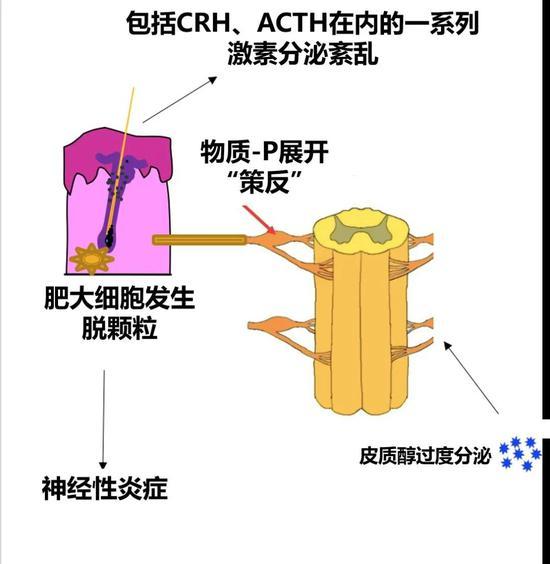 当前关于压力脱发机制的主流理论模型