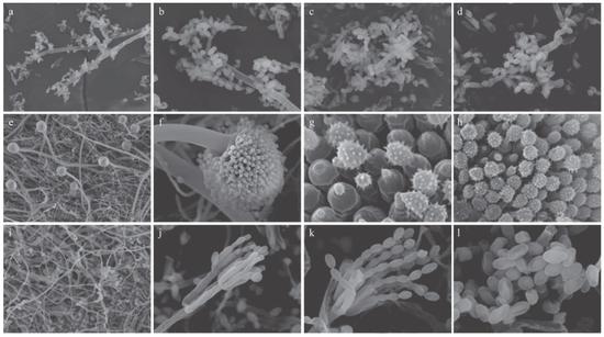 冰箱里检出的微生物。图片来源:《家庭冰箱中的微生物种类调查》