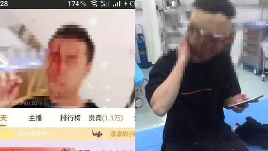 国内也有过主播受到袭击的事件