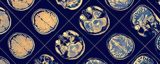 图源:Science Alert
