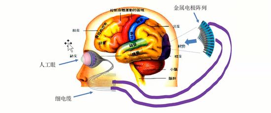 图|全眼球替换方案(来源:范智勇)