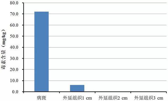 番茄腐烂病斑及其外延组织中毒素检测结果
