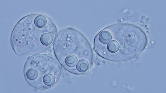 粘孢子虫的一个生命阶段生活在鱼类体内,另一个阶段则生活在水生蠕虫中。有研究者提出,这种寄生虫可能有一个奇怪的起源:以一种传染性肿瘤的形式演化成独立的物种