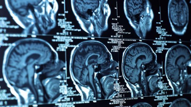 科学家找不到精神疾病与创造力之间存在某种关联的科学理由。