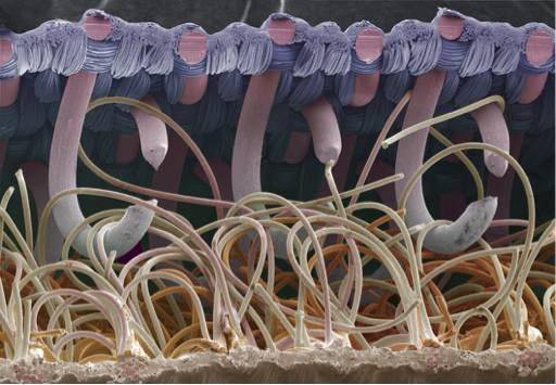 维可牢的扫描电镜图片展现了它与牛蒡钩刺的相似性。图片来源:Science Photo Library
