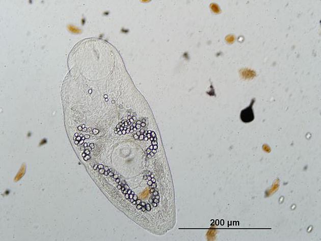 图为Ribeiroia ondatrae,是一种导致两栖动物肢体畸形的寄生虫。研究人员的保护计划中未收录任何可感染人类或家畜的寄生虫。