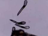 螨虫“时日无多”？英媒：螨虫DNA之间差异越来越小，或向灭绝