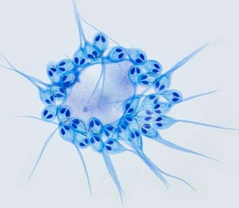 研究人员利用深度测序和荧光显微镜对Henneguya salminicola进行深入分析,发现它们已失去线粒体基因组,此外,也失去了有氧呼吸能力,几乎所有参与转录和复制线粒体的细胞核基因都已丧失。