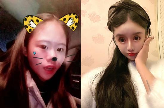 周楚娜整容前后对比照。受访者供图