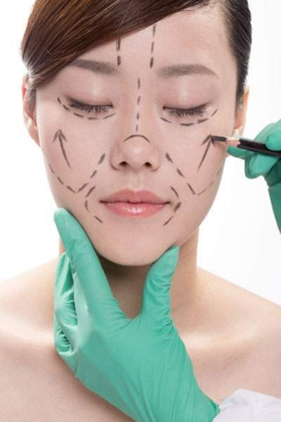 抗衰老蛋白埋线