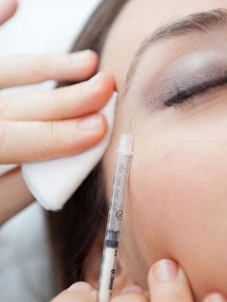 透明质酸填充剂