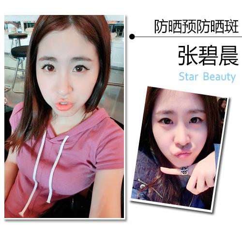 张碧晨的皮肤天生白皙